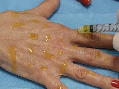 BioRepeelCL3 Body - Tamara's Clinic