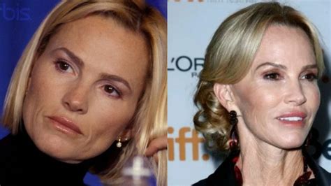 Janet Gretzky’s Plastic Surgery: Do You Know She Is 62 Years Old?