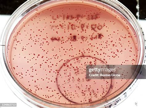 Coli Cell Photos and Premium High Res Pictures - Getty Images