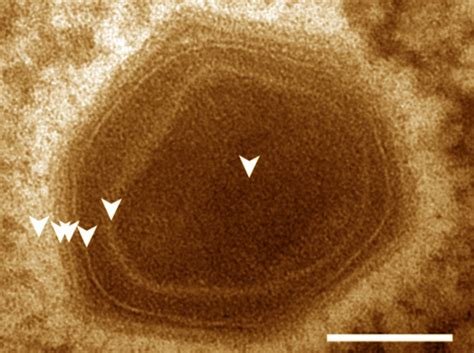 Bodo saltans Virus: Researchers Find Microzooplankton-Infecting Giant ...