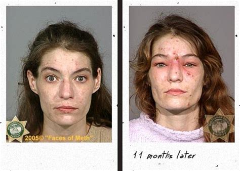 Health Info and Tips: Drug Addicts : Before and After