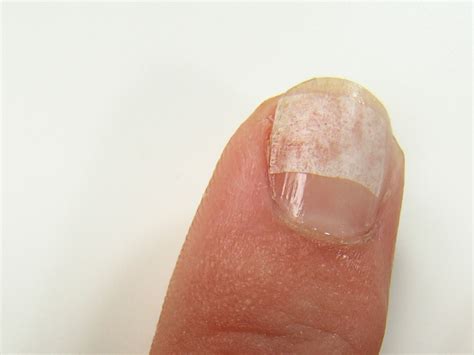 Quick & easy way to bandage a cracked nail | Lipstick Latitude
