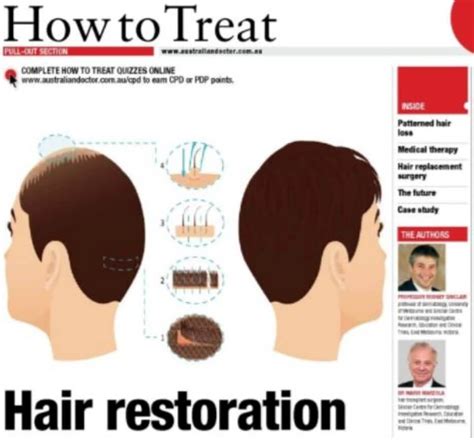 Hair restoration treatments for all types of hair loss | Sinclair Dermatology