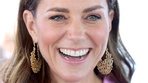 Kate Middleton teeth: what has Duchess of Cambridge done to her smile ...