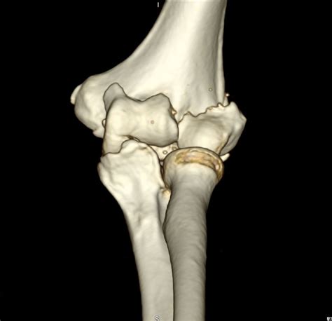 Ellenbogen 6.0001 - DocCheck