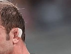 Why And How Do Rugby Players Tape Their Ears? (Tips And Examples ...