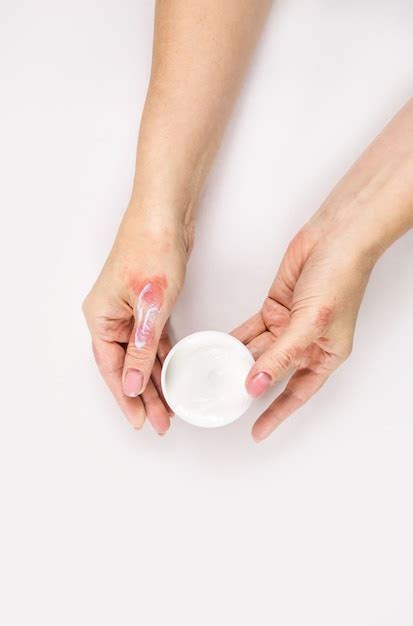 Premium Photo | Cream for the treatment of dermatitis.