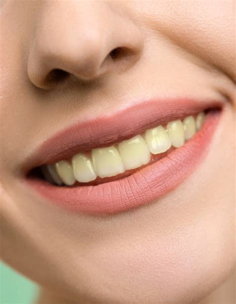 Teeth Whitening – Stanstead Dental Centre