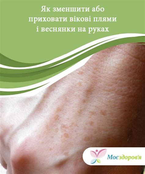 Як зменшити або приховати вікові плями і веснянки на руках | Gym shorts ...