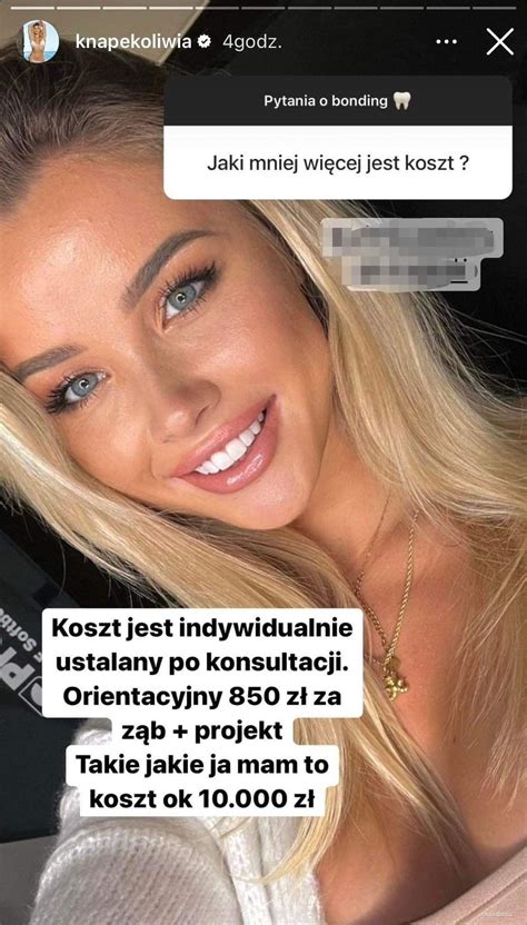 "Love Island": Oliwia Knapek z 2. edycji zaskoczyła swoją metamorfozą