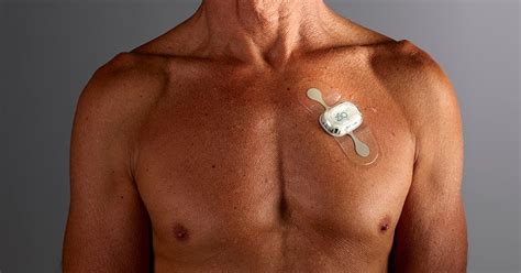 iRhythm digital heart monitoring service backed by NICE | pharmaphorum
