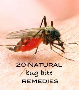 Summer Care Tip: 20 Natural Bug Bite Remedies - One Part Sunshine