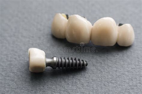 Single Denture and Dental Crown on Gray Close-up Stock Photo - Image of ...