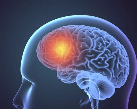 epilepsy symptoms  treatment optimists