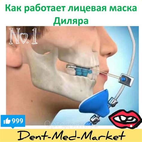 Лицевая Маска Ортодонтия Фото — Картинки фотографии