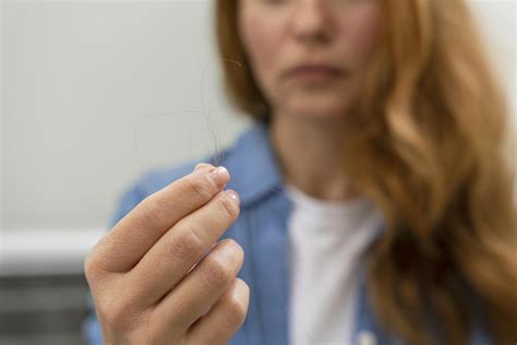 Queda De Cabelo Zinco - Queda de cabelo por deficiência de minerais | Ferro, zinco, selênio