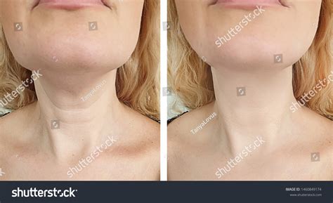 wrinkled images stock  vectors shutterstock