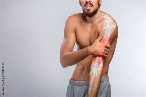 Human arm pain, anatomy of human arm Stock Photo | Adobe Stock