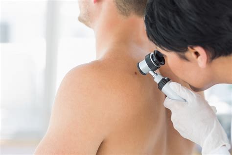Kyste sébacé : causes, traitements et prévention - Top Santé