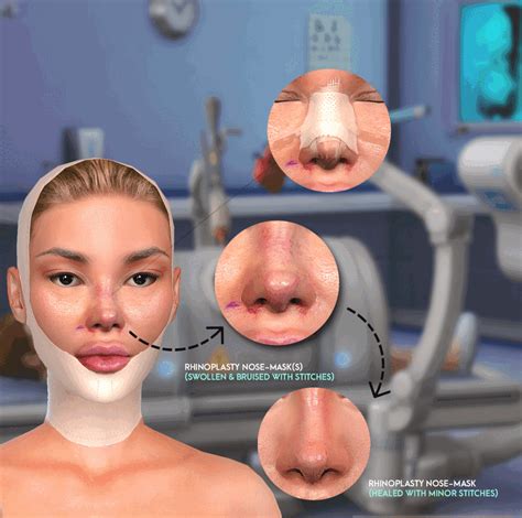 “RECOVERY COLLECTION” (Nose Job & Facial Surgery RP Kit) | Sims 4