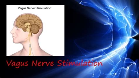 Vagus Nerve Stimulation and Balancing - Rife Frequencies and More