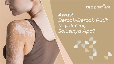 bercak putih  tubuh hipopigmentasi  solusinya dok youtube