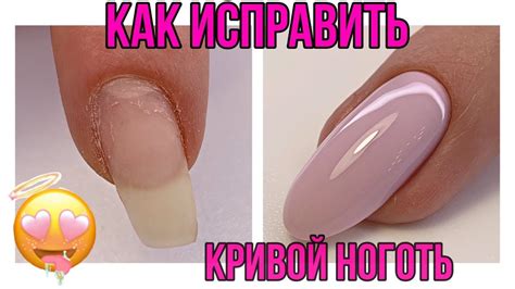 Лайфхак😍Как исправить кривой ноготь💅в сторону растущий ноготь💅Дизайн ...