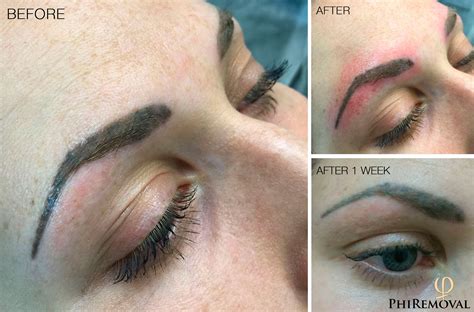 Permanent Makeup / Tattoo Removal - In A Wink Lash & Beauty Lounge