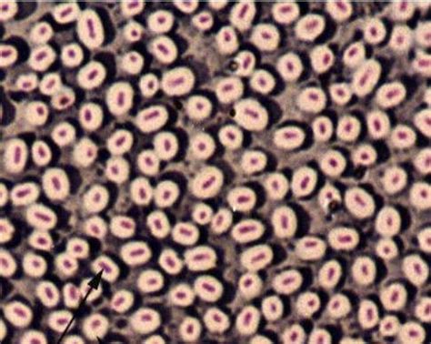 (LAB) Negative Stain Technique of Bacterial Capsules Diagram | Quizlet