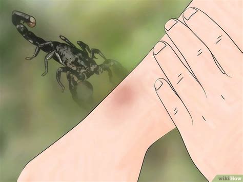 Como Identificar uma Picada de Aranha: 7 Passos