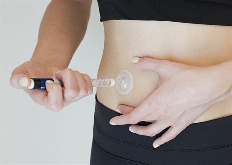 introducing  port advance injection port  loop blog