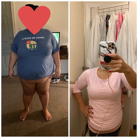184 best Rny images on Pholder | Wls, Progresspics and Gastric Bypass