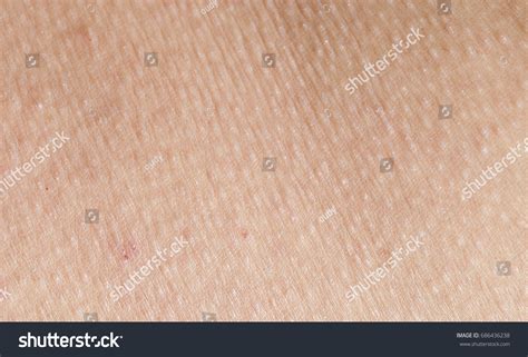 Skin Rashes That Allergic Sweat Cosmetics Stock Photo 686436238 | Shutterstock