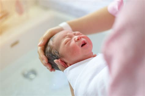 mengulik seputar kelainan kongenital  bayi  lahir