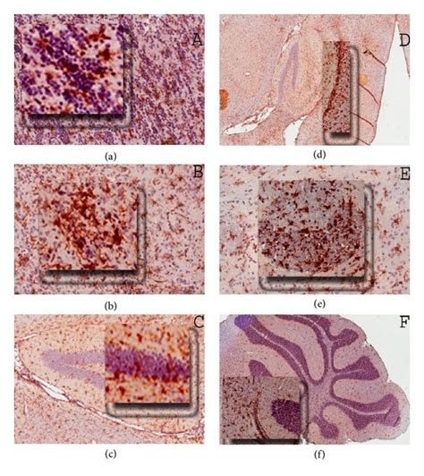 accumulation  activated amoeboid microglia   inflamed brain