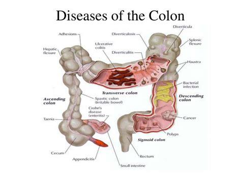 PPT - The Colon PowerPoint Presentation, free download - ID:3754421