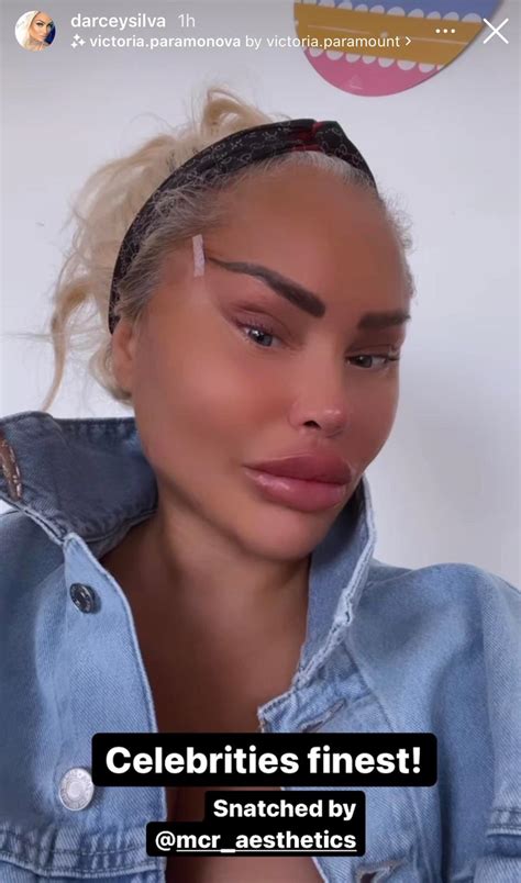 Darcey, Stacey Silva look unrecognizable after plastic surgery