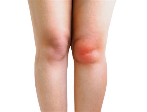 Knee Replacement Screening Package | Hip & Knee Orthopaedics