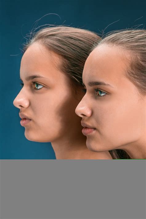 Beauty experts explain why does marie's face look different now 11