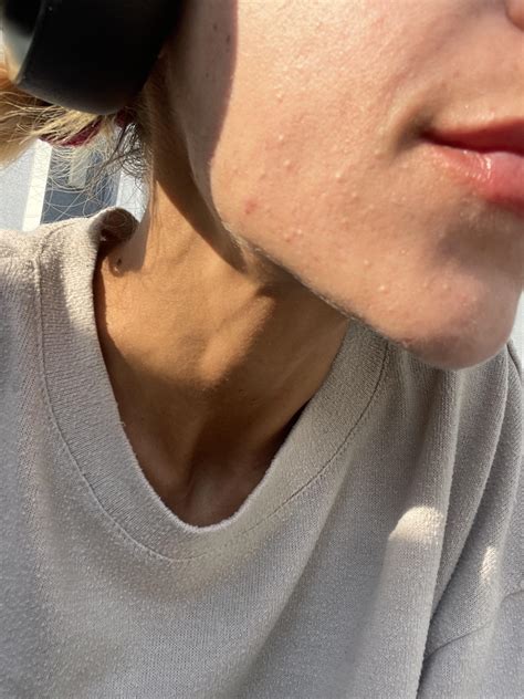 Nothing I’m doing makes this go away. I’m frustrated and sad. Open to