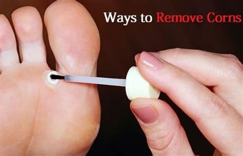 how to remove corns at home