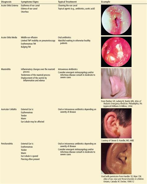 Ear Infections in Adults | Anesthesia Key