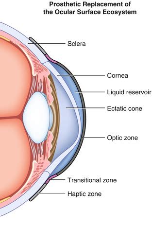 Diagnosis and Management of Ocular Surface Disease | Ento Key