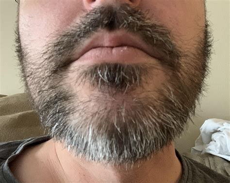 Bushy beard potential : r/BeardAdvice