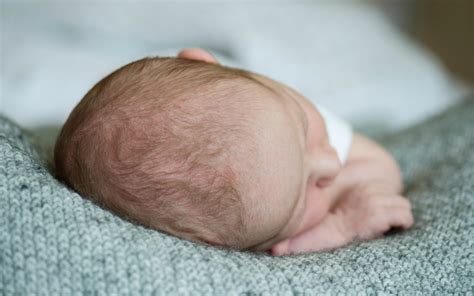 Should I Worry If My Baby Has a Flat Head? New Research Released