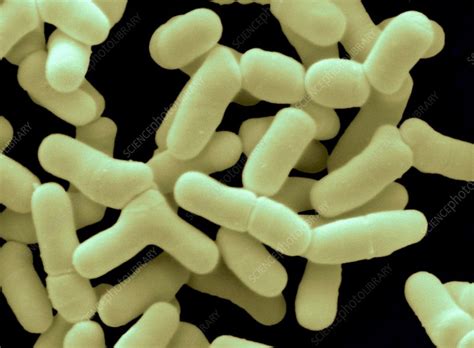 bifidobacterium bifidum stock image  science photo library