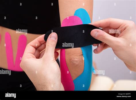 Close-up Of Physiotherapist Applying Kinesiology Tape On Patient's ...