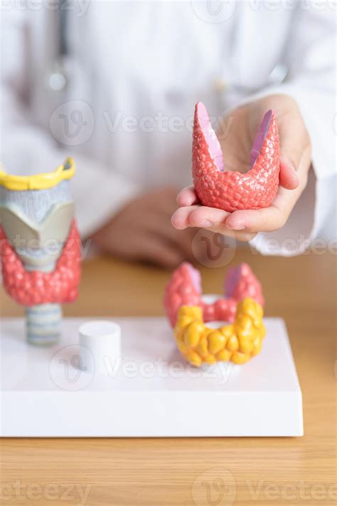 médico com humano tireoide anatomia modelo. hipertireoidismo, hipotireoidismo, hashimoto