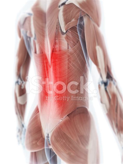 Painful Back Muscles Stock Photo | Royalty-Free | FreeImages