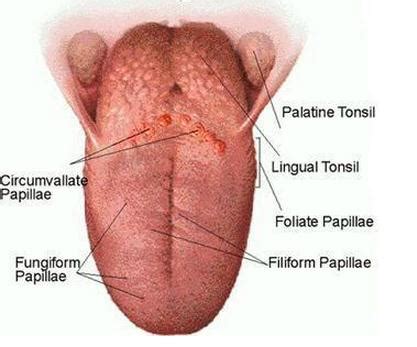 Inflamed Taste Bud - Pictures, Causes, Treatment, Home Remedies